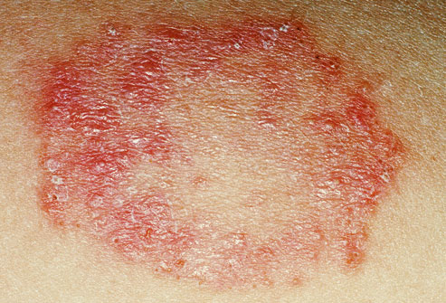 Derma